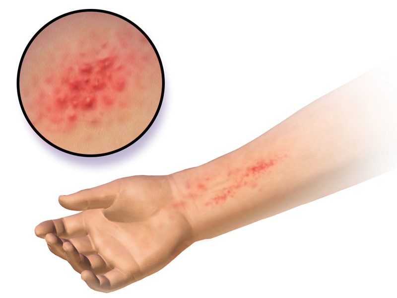 How do you identify a rash on your fingers?